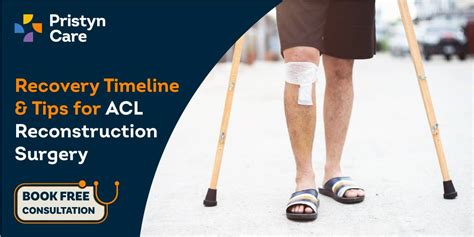 acl surgery greenwich|Recovery Time For ACL Surgery: Timeline, Tips, and FAQ’s.